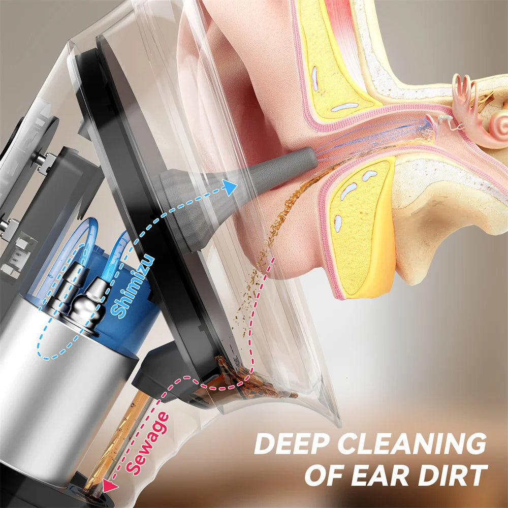 Electric Ear Irrigation Kit – Safe Water Pressure Ear Wax Removal with Temperature Sensor